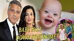 Unraveling the Truth: Do George Clooney's Children Face Down Syndrome's Challenges?