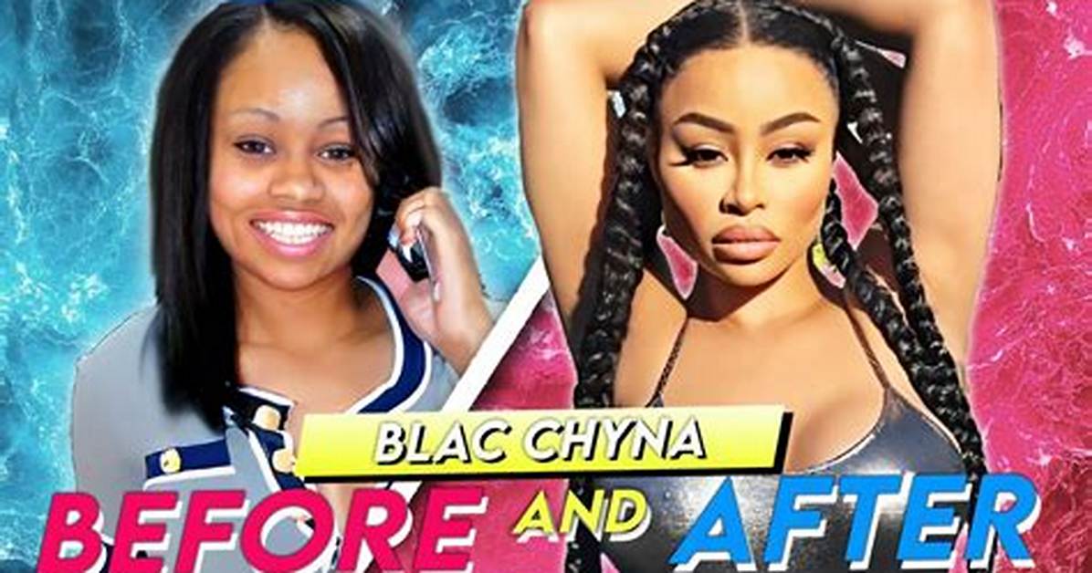 Unveiling Black Chyna's Journey: Before and After Surgery