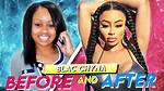 Unveiling Black Chyna's Journey: Before and After Surgery