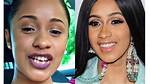Unveiling Cardi B's Teeth Transformation: a Journey of Discovery