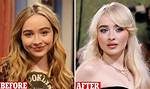 Unveiling Sabrina Carpenter's Cheek Implants Journey