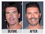 Unveiling Simon Cowell: a Look at His Family and Children