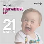 Unveiling the Enigmatic World of Down Syndrome Hippos: Discoveries and Insights