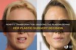 Unveiling the Secrets of Brandy Renee Surgery: Discoveries and Insights Revealed