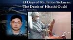 Unveiling the Tragic Journey: Hisashi Ouchi's Medical Report