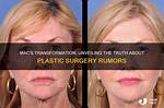 Unveiling the Transformation: Ahna Mac Face Surgery