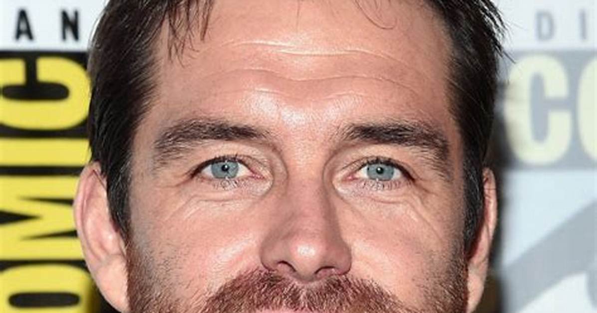 Unveiling the Truth Behind Antony Starr’s Botox Rumors