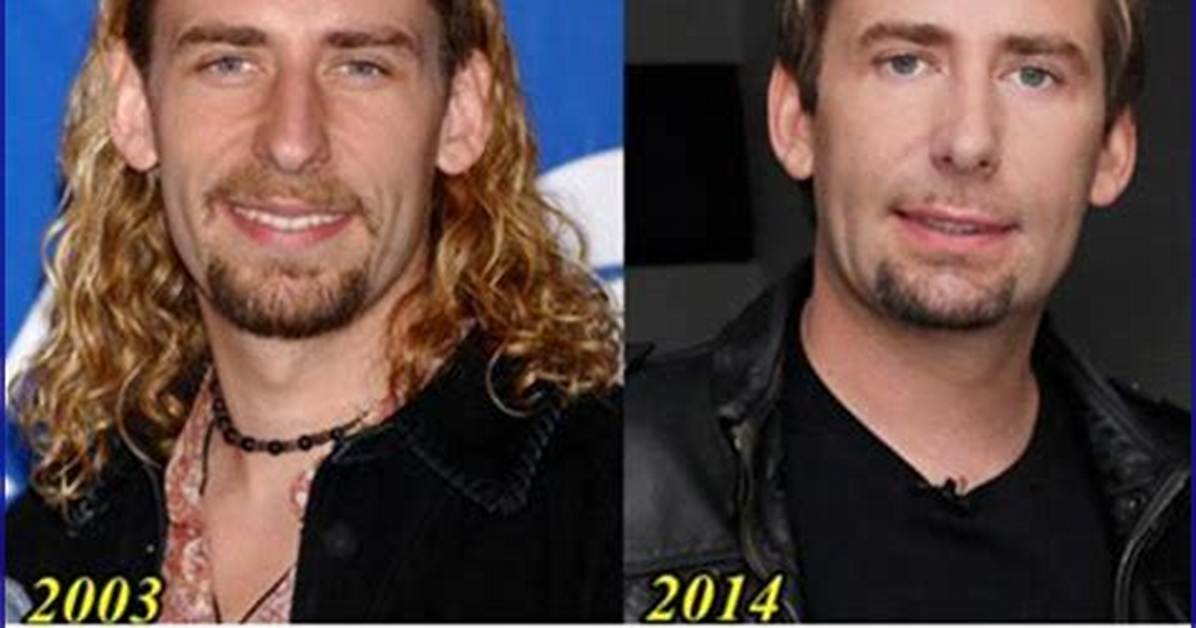 Unveiling the Truth Behind Chad Kroeger Cosmetic Surgery: a Deep Dive