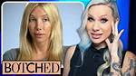 Unveiling the Truth Behind Kimber James Botched