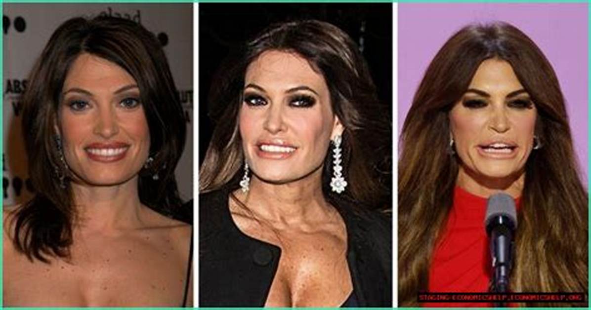 Unveiling the Truth Behind Kimberly Guilfoyle Plastic Surgery