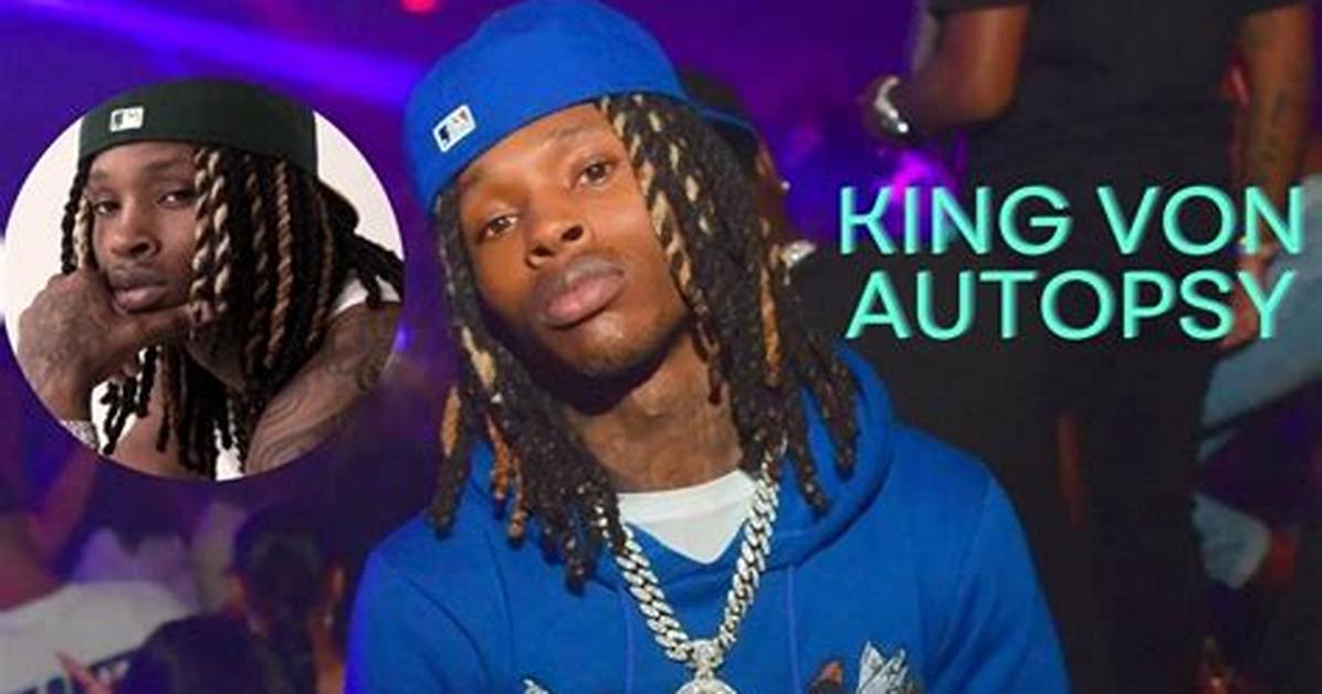 Unveiling the Truth: the King Von Autopsy Picture and Its Impact