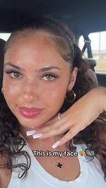 Who Is Tiktok’s @Ashaley. Nucole? Images of Ash Kaash Before Surgery